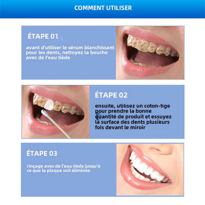 BANCHISSEUR  DE DENTS EN 3 JOURS
